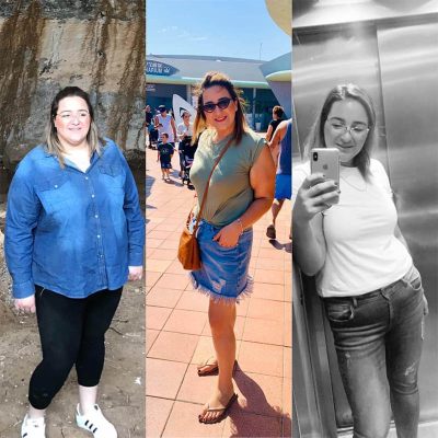 ניתוח השמנת יתר