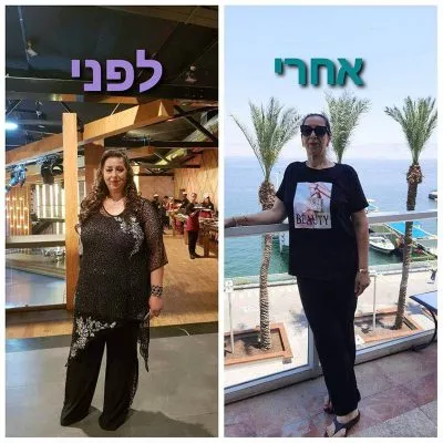 ניתוח השמנת יתר