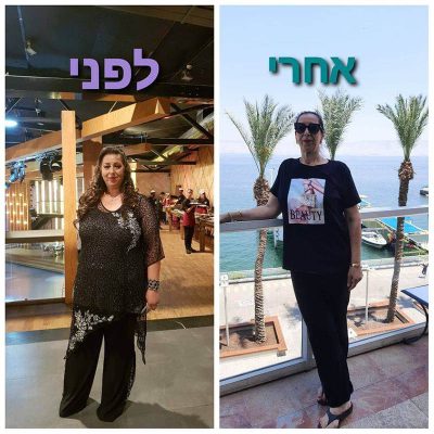 ניתוח השמנת יתר