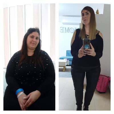 hashan_0006_beforeandafter07