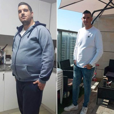 ניתוח השמנת יתר